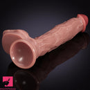 10in Oversized Huge Thick Skin Feeling Dildo For Female Anus Expander