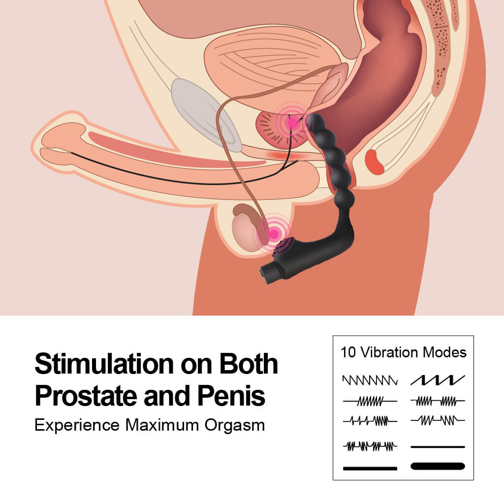 Male Prostate Massage Butt Plug 10 Frequencies Vibrating Sex Toy - Adult Toys