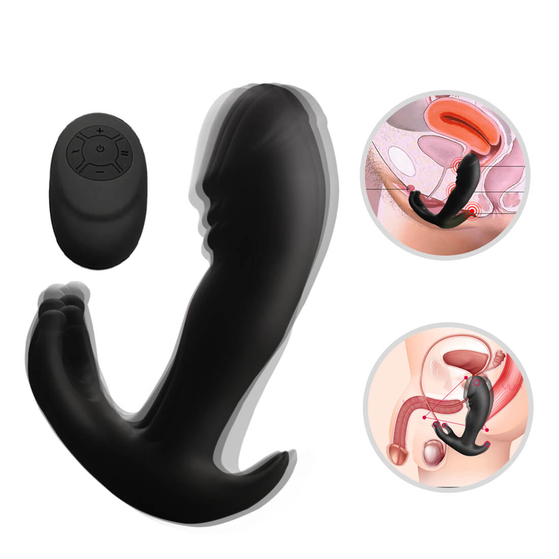 Prostate Massager Waterproof Butt Plug Prostate Vibrator - Adult Toys